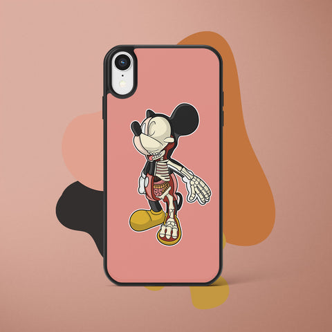 Ốp lưng iphone in hình Half Skeleton - Mickey (đủ model iphone)